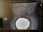 Ядра окостенения, рентген ребёнка в 4 месяца фото 2
