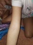 Сыпь по всему телу у ребенка 8 лет фото 2