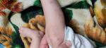Сыпь на руках и ногах ребенок 1 год фото 4