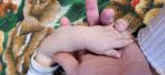 Сыпь на руках и ногах ребенок 1 год фото 1