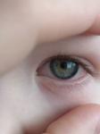 Покраснел глаз у ребёнка фото 1