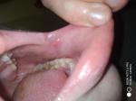 На внутренней стороне губы шышечка фото 2
