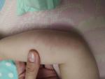 Сыпь на животе у ребенка фото 3