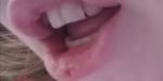 Дырка в переднем зубе фото 1