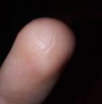 Поражения на коже пальца и они растут фото 2