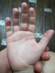 Облазет кожа на пальцах у ребенка фото 1