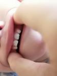 Налёт на зубах у ребенка фото 1