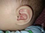 Аллергия в ушах? фото 1