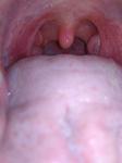 Красное горло без других симптомов долго не проходит фото 2