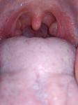 Красное горло без других симптомов долго не проходит фото 1