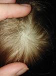 Точечки растущих волос на голове у ребёнка фото 3