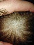 Точечки растущих волос на голове у ребёнка фото 1