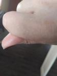 Причина боли при нажатии на палец фото 1