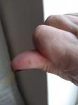 Причина боли при нажатии на палец фото 3