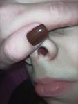 Кровь из носа у ребенка 13 лет фото 3