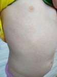 Аллергия у ребёнка 3,5 лет, подозрения на сфинкса фото 1