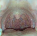 Странные миндалины горла фото 1