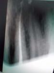 Стоматолог покалечил зубы, а после нахамил фото 1