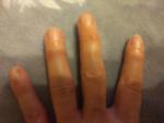 Болят суставы пальцев рук фото 3