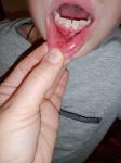 Красные пятна во рту у ребёнка фото 1