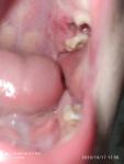 Зуб у ребенка фото 3
