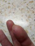 Трещины на лодошках и пальцах рук глубокие ранки с шелушеним фото 2