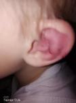 Сильный ушиб уха у ребёнка 4 года фото 1