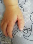 Красная сыпь на руках у ребенка фото 1