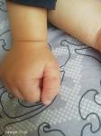Красная сыпь на руках у ребенка фото 4