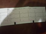 Заключение кардиограммы фото 1