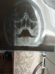 Описание рентген снимка пазух носа фото 1