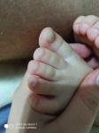 Изменения ногтей на ногах у ребенка 2 года фото 2