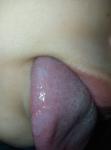 Болячка внутри губы фото 2