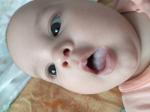 Белый налет на языке младенца фото 1