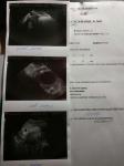 Зачатие во время болезни Covid 19 фото 4