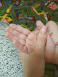 Облезают пальцы рук у ребенка фото 1