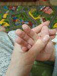 Облезают пальцы рук у ребенка фото 4