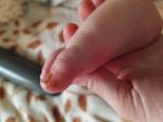 Непонятное шелешение пальца ногтя ноги фото 2