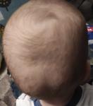 Кривая голова с рождения фото 1