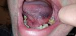 Болит язык слева фото 2