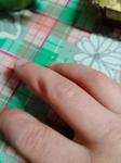 Онемение пальца без травмы фото 1