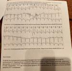 Результаты холтера и смарта фото 1
