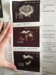 Тест показывает 2 полоски, но нет беременности фото 2