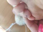 Чёрное пятнышко на пальце ноги фото 3
