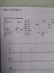 Нужна расшифровка кардиограммы, дышать тяжело фото 1