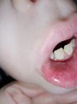 Непонятные пятна на губе у ребенка фото 1