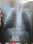 Рентген ребенка, помощь в расшифровке фото 2