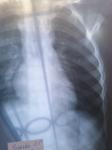 Рентген ребенка, помощь в расшифровке фото 5