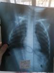 Рентген ребенка, помощь в расшифровке фото 4