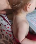 Красные пятна на шее у ребенка. Лишай? фото 4